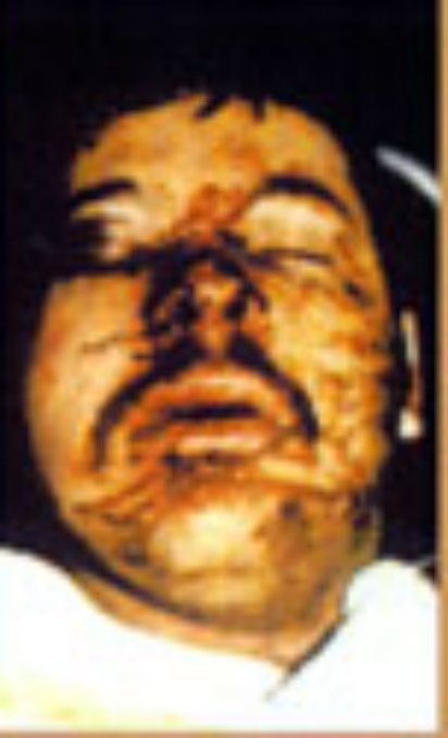 Long Kesh Internment Torture II