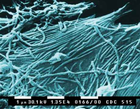 ebola_virus.jpg