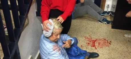 volunteers administer first aid in the aftermath of a paramilitary Guardia Civil attack on a voting centre. 